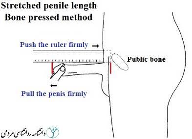 اندازه آلت تناسلی