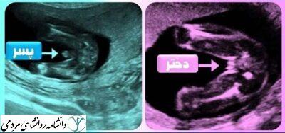 رشد جنسی جنین