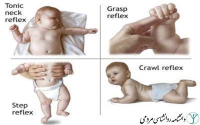 بازتاب‌های نوزاد
